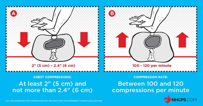 Minh họa kỹ thuật &eacute;p tim ngo&agrave;i lồng ngực (CPR) đ&uacute;ng chuẩn AHA, tốc độ 100 - 120 lần/ph&uacute;t, độ s&acirc;u 5 - 6 cm, cho ph&eacute;p lồng ngực nở ho&agrave;n to&agrave;n giữa c&aacute;c nhịp &eacute;p